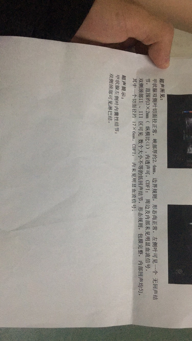 082319tcvrcs9vyrp9cnmc.jpg