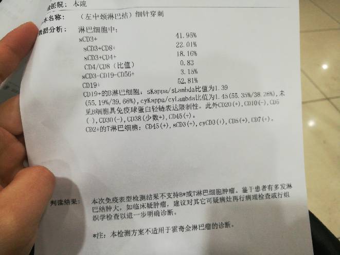 151217ip085hdat8ggthwg.jpg