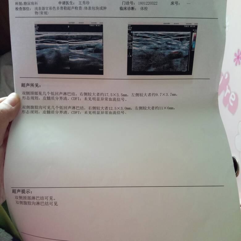 153650cdtb0588mt8h0u1d.jpg