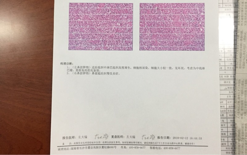 232334s001dpl0md0bjlgc.jpg