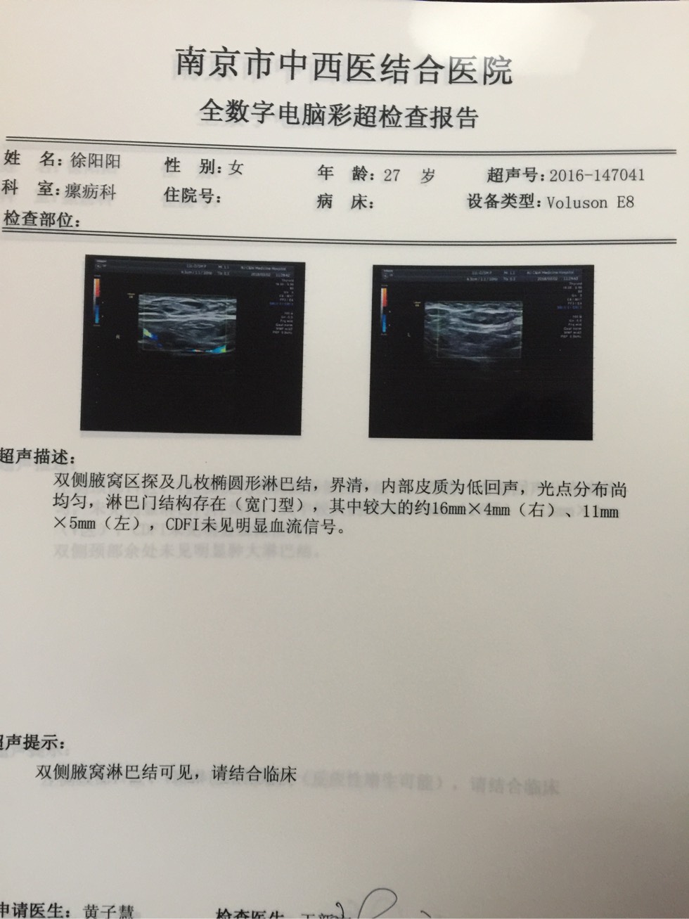 112700j132s0r4v93swl33.jpg