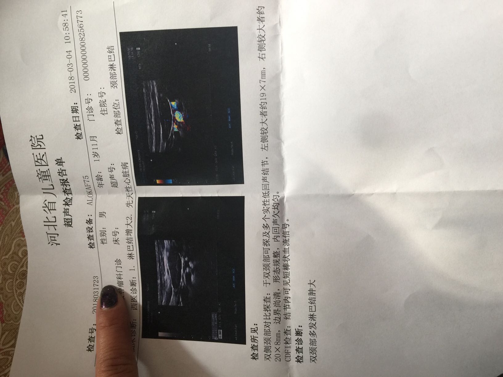 154014ic82lwc3c8lzmxsm.jpg
