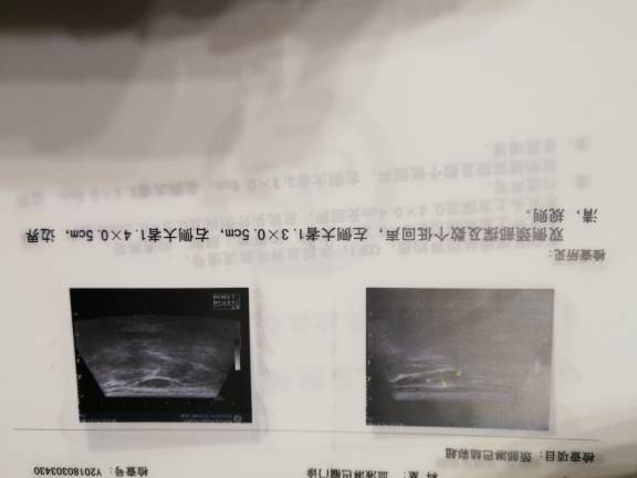 221708db70tf1aaax5q50y.jpg