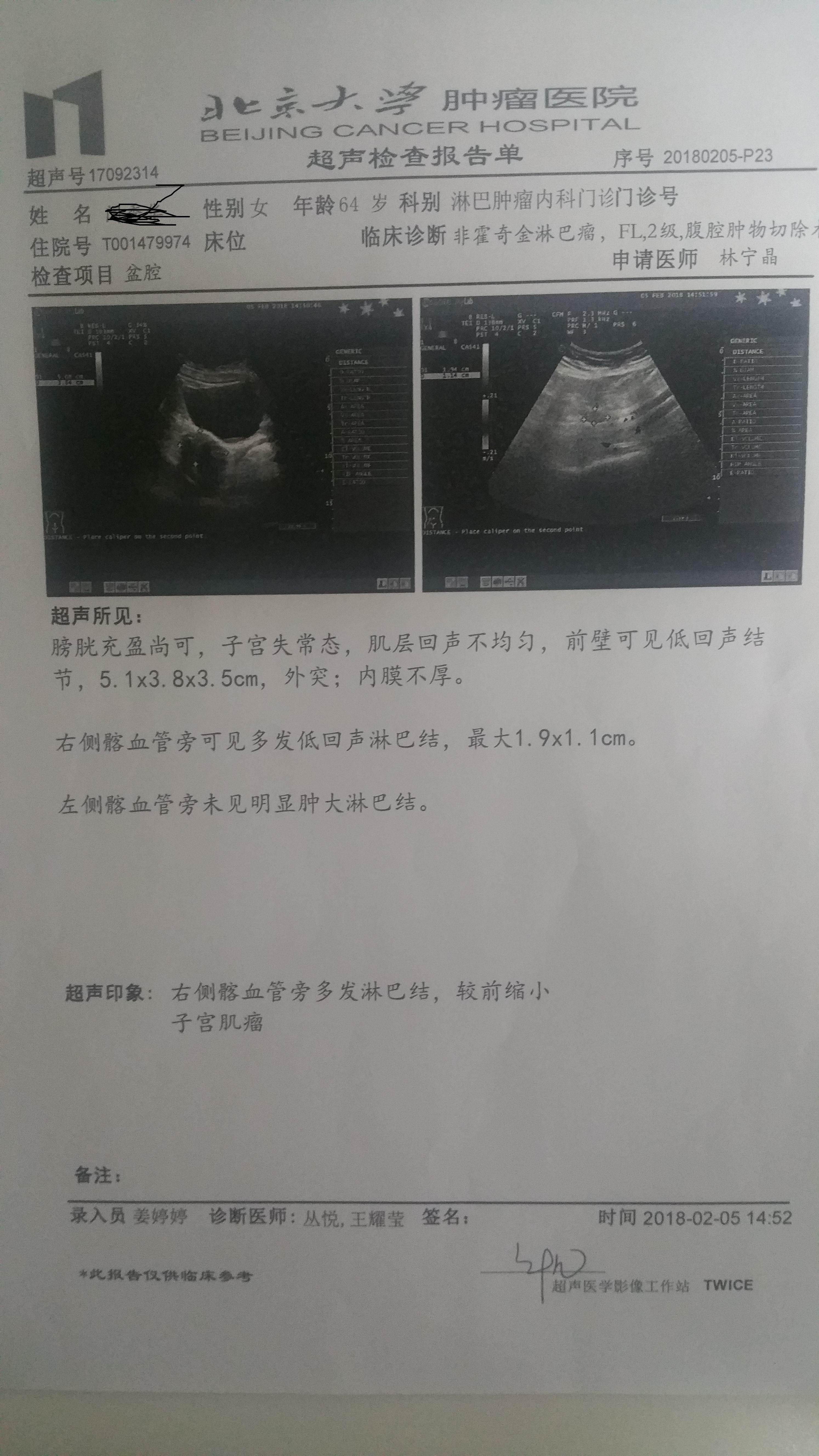 2018.02.05肿瘤医院盆腔B超.jpg