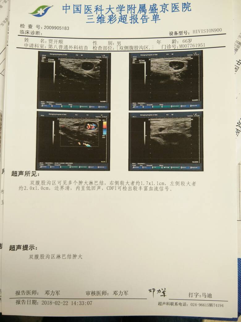 093921a7nb9fw991huop9l.jpg