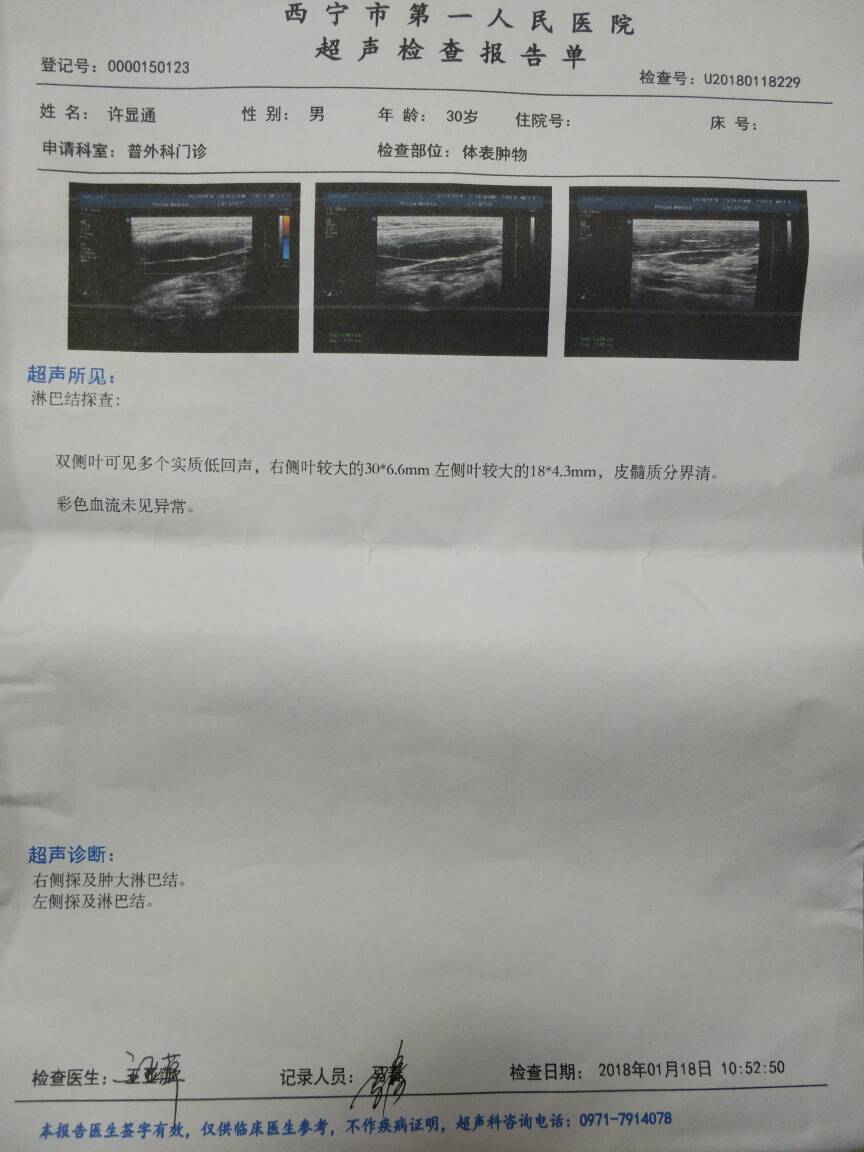 155756rcjppofsmos2zf4b.jpg