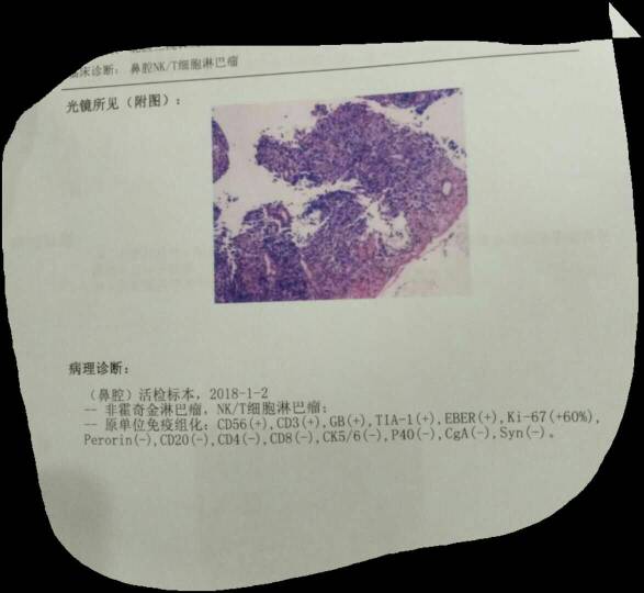 160943sxtddxmdfs3civv6.jpg