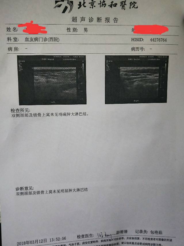 184749zp4ap4eax1e4aexg.jpg