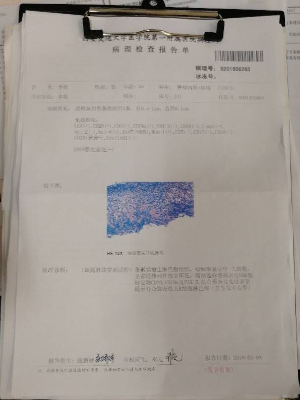 170202fo5cnnqjqg5o94aa.jpg