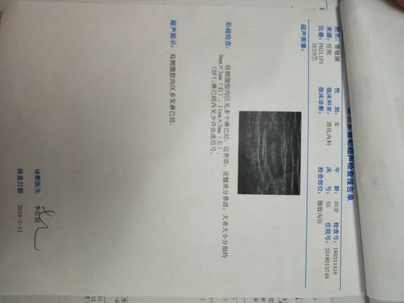 184820lsskszlj10fk82js.jpg