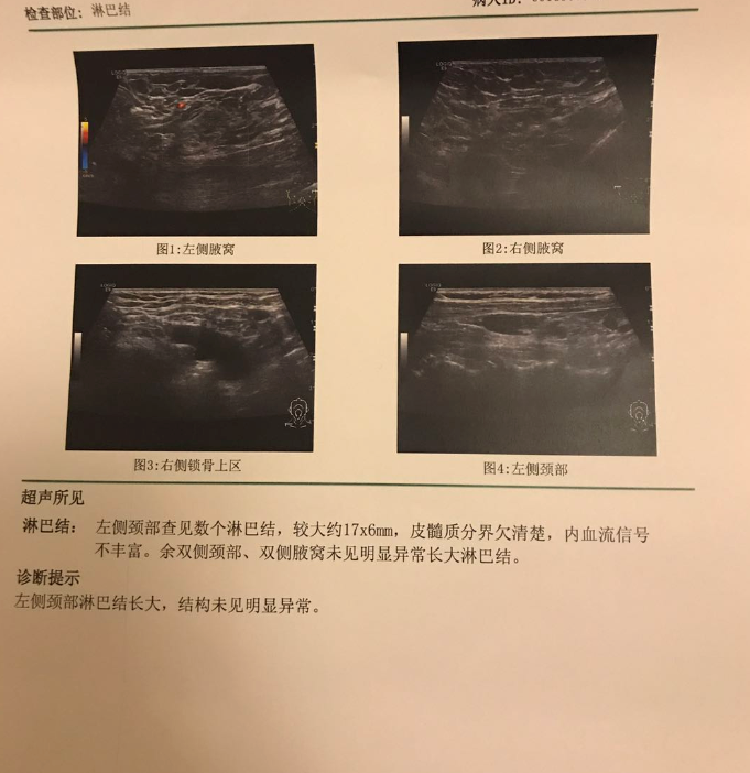 QQ图片20180321170115.png