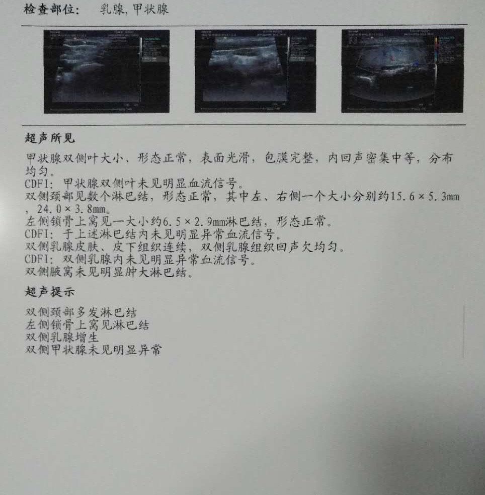221029j4np4n19u12vhv0p.jpg