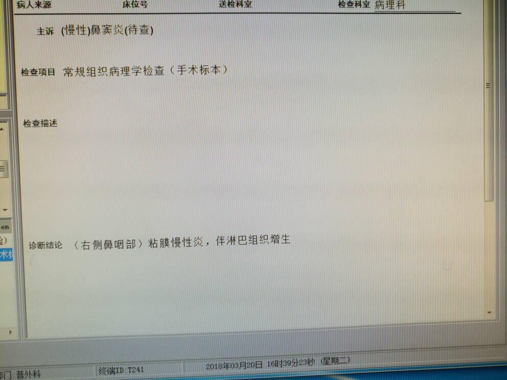 203730efmervp0adv44ri4.jpg