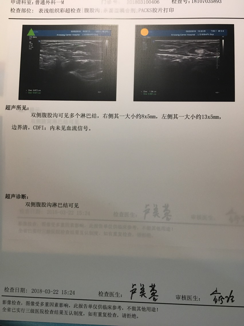 145144u3xxpir9qxiunup3.jpg