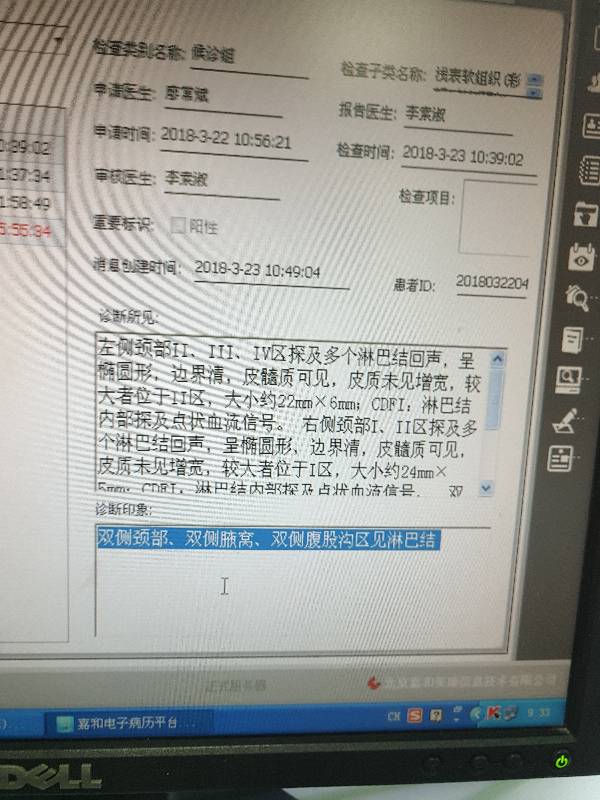 094648gz6lnz3ysu3nazsf.jpg