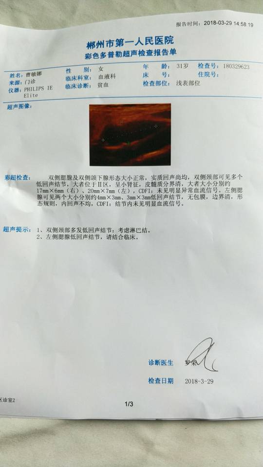 160325ov11hazzv8q8v55g.jpg