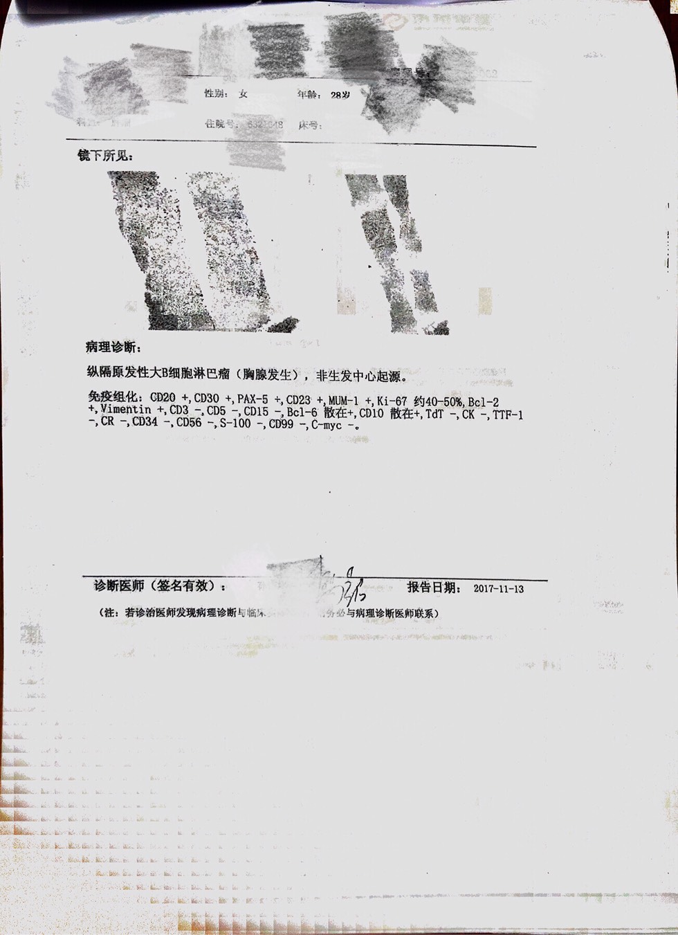 232544qd2tncdir6zqn6dn.jpg