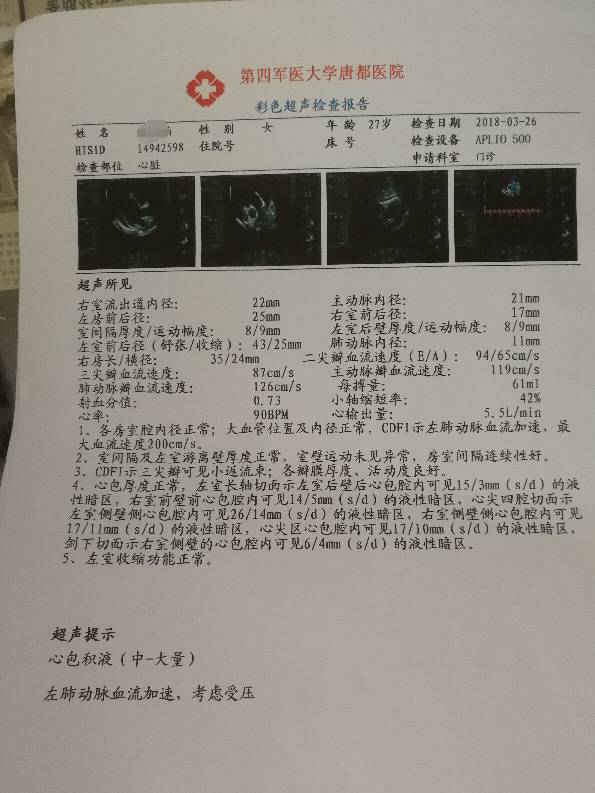 153814uvk33khj3rr1hktr.jpg