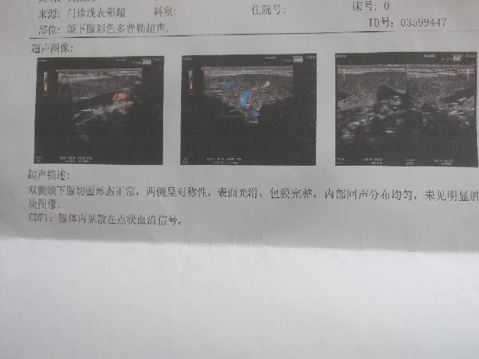 122922w0jrqnqypvx972x7.jpg