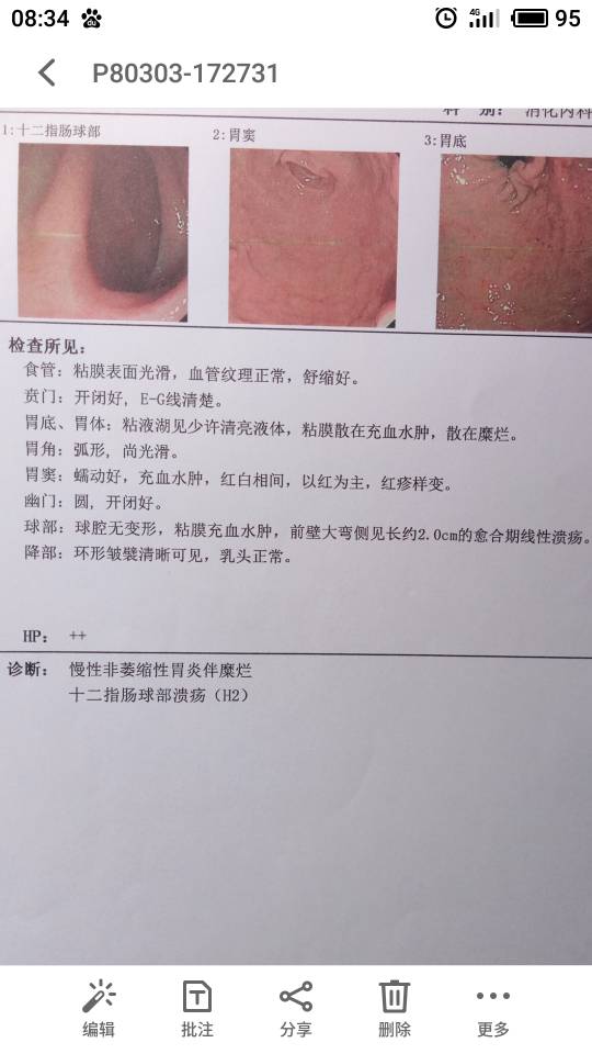 083929ip9n99ghxpilpigs.jpg