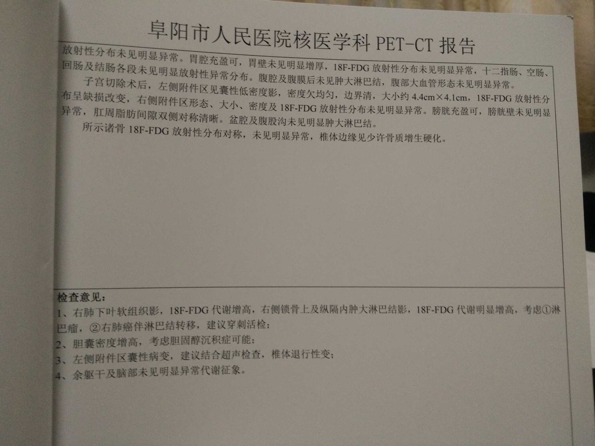 155521yp5b32pirpr2j51e.jpg