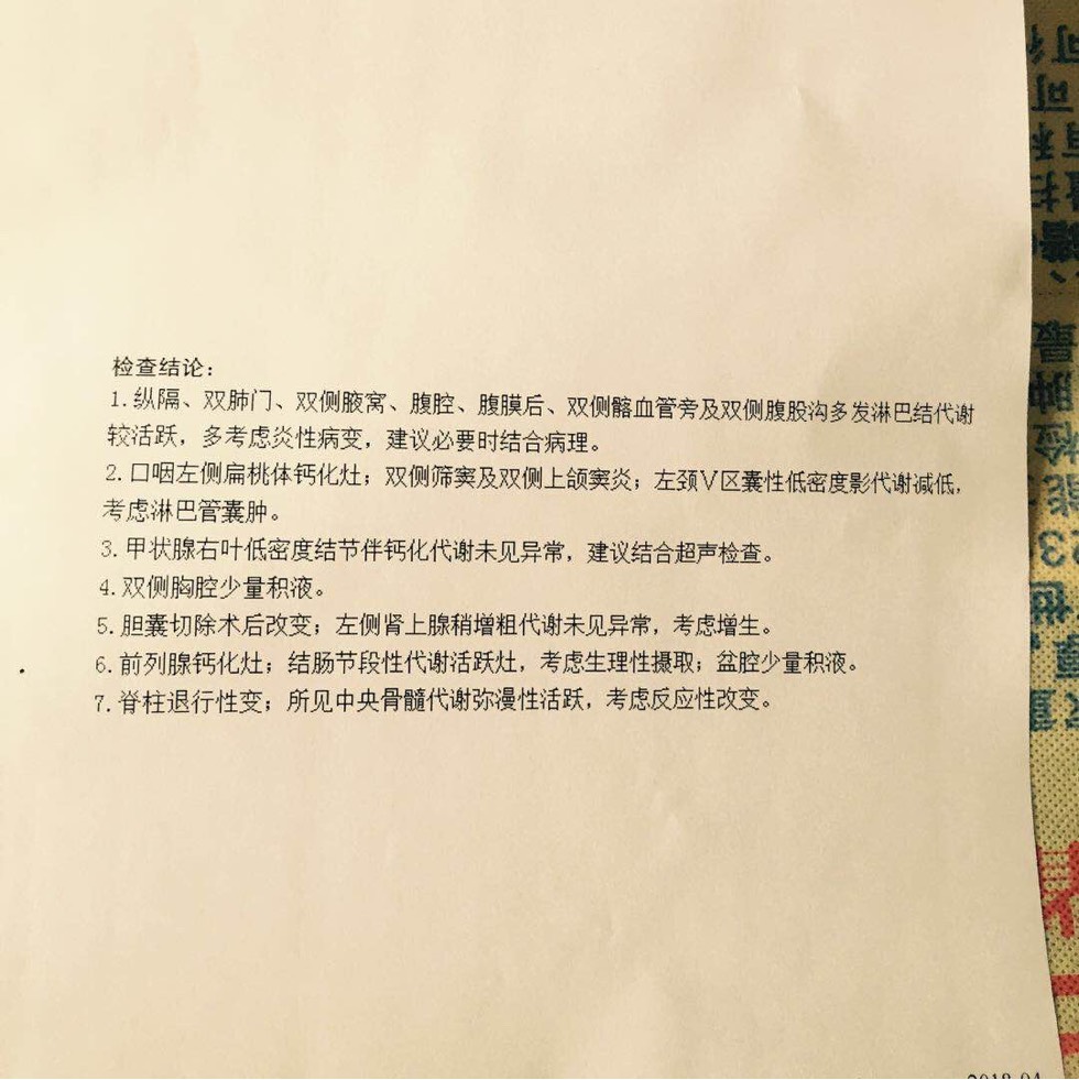 160305ds1ppvpvpvfpf13d.jpg