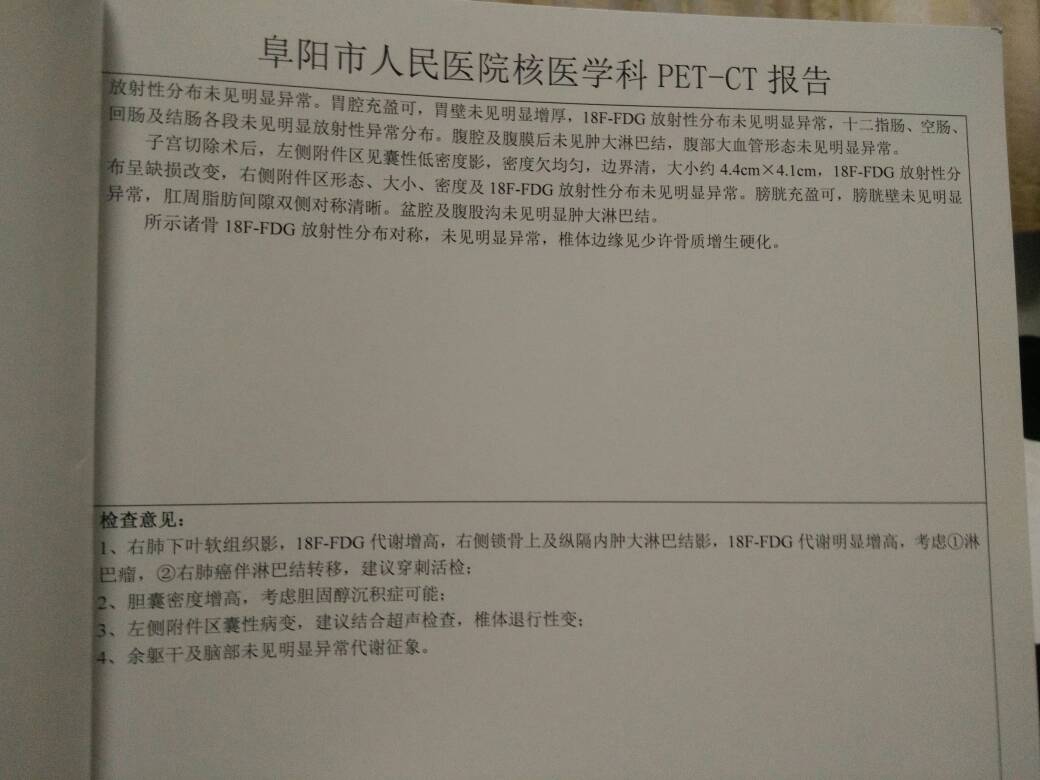 084826dwo3g3isswslikw2.jpg