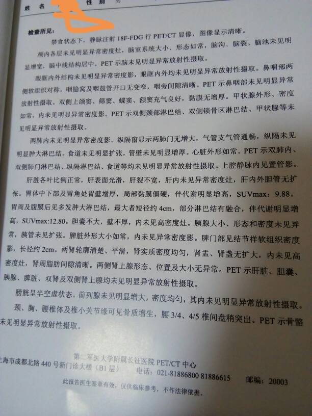 095756oqp0jzj6d3dt31zs.jpg