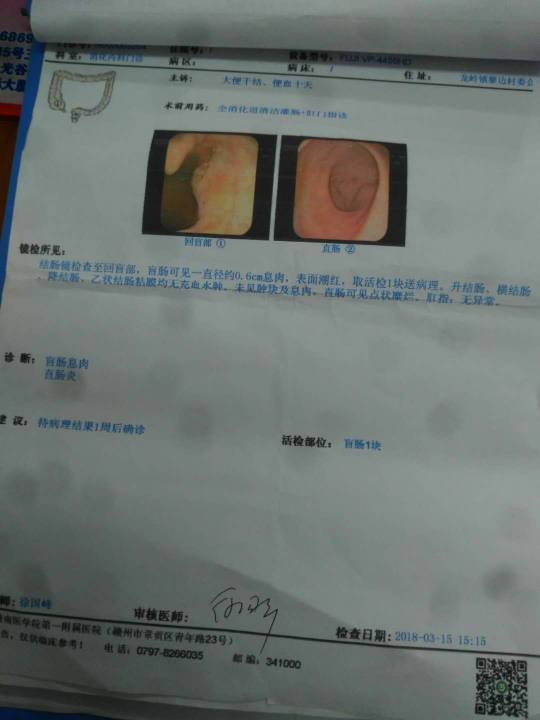 172118bme5m15k5b7cqra8.jpg