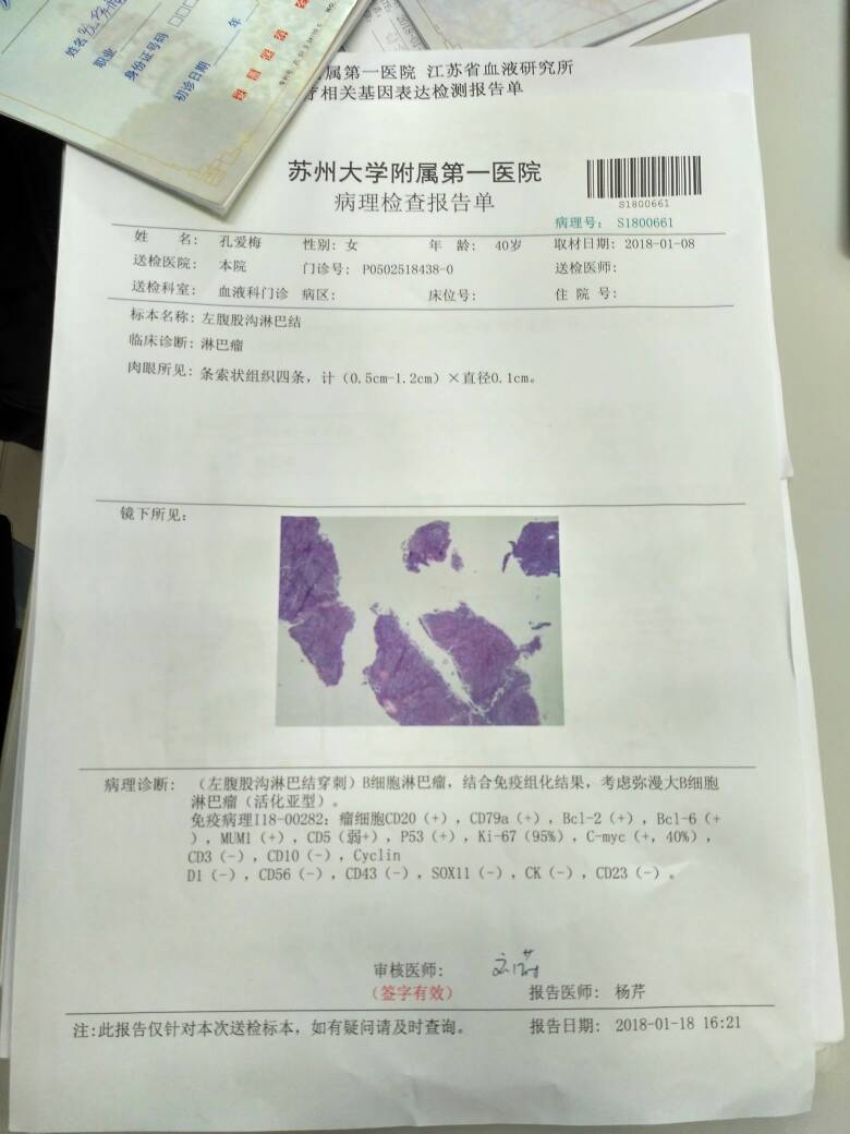 184434itc902ct24zh7r4n.jpg