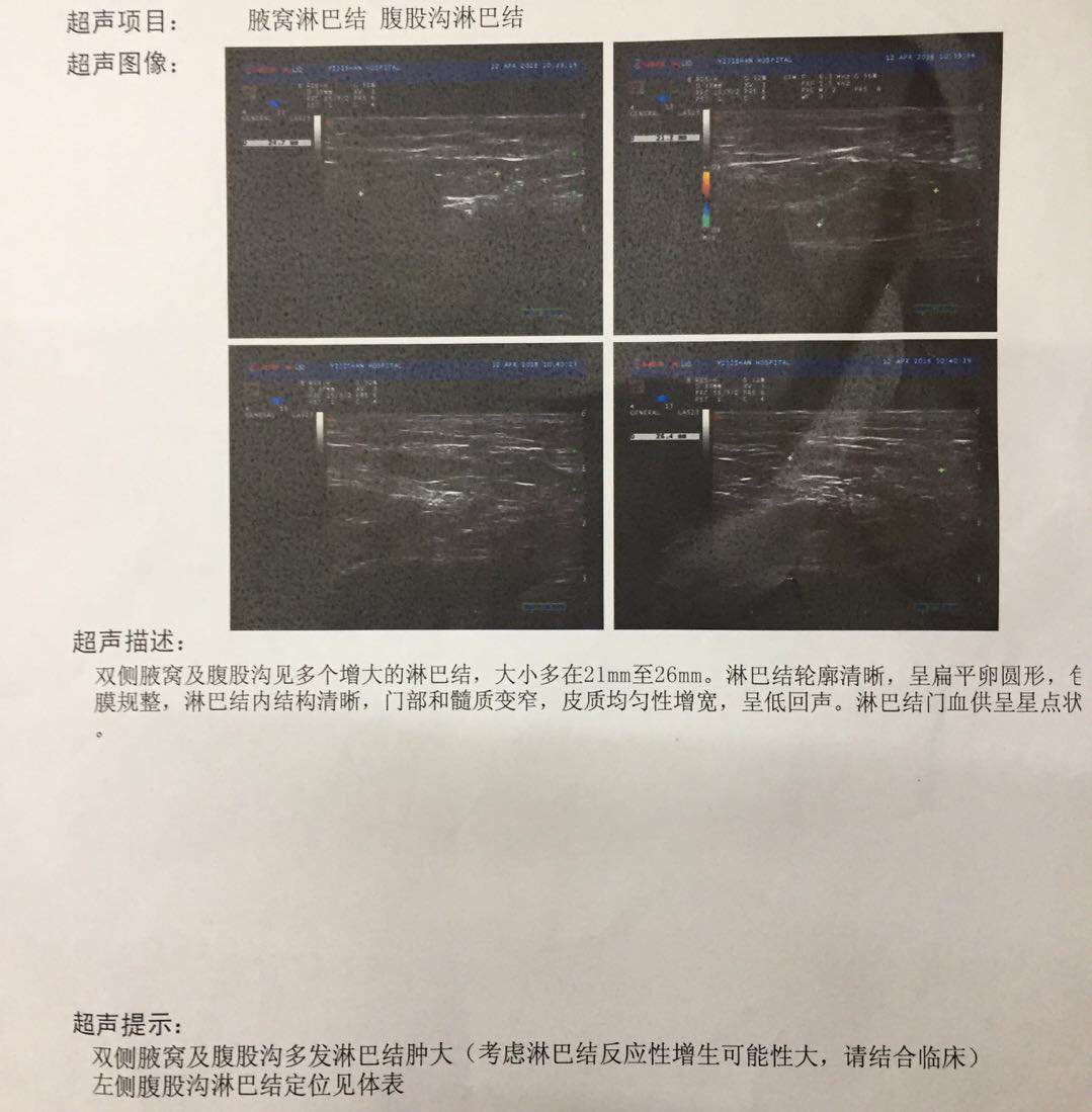 定位B超