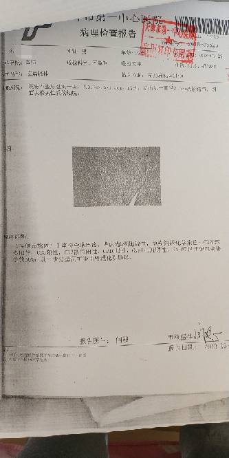 102136r0ditzd86tytl69o.jpg
