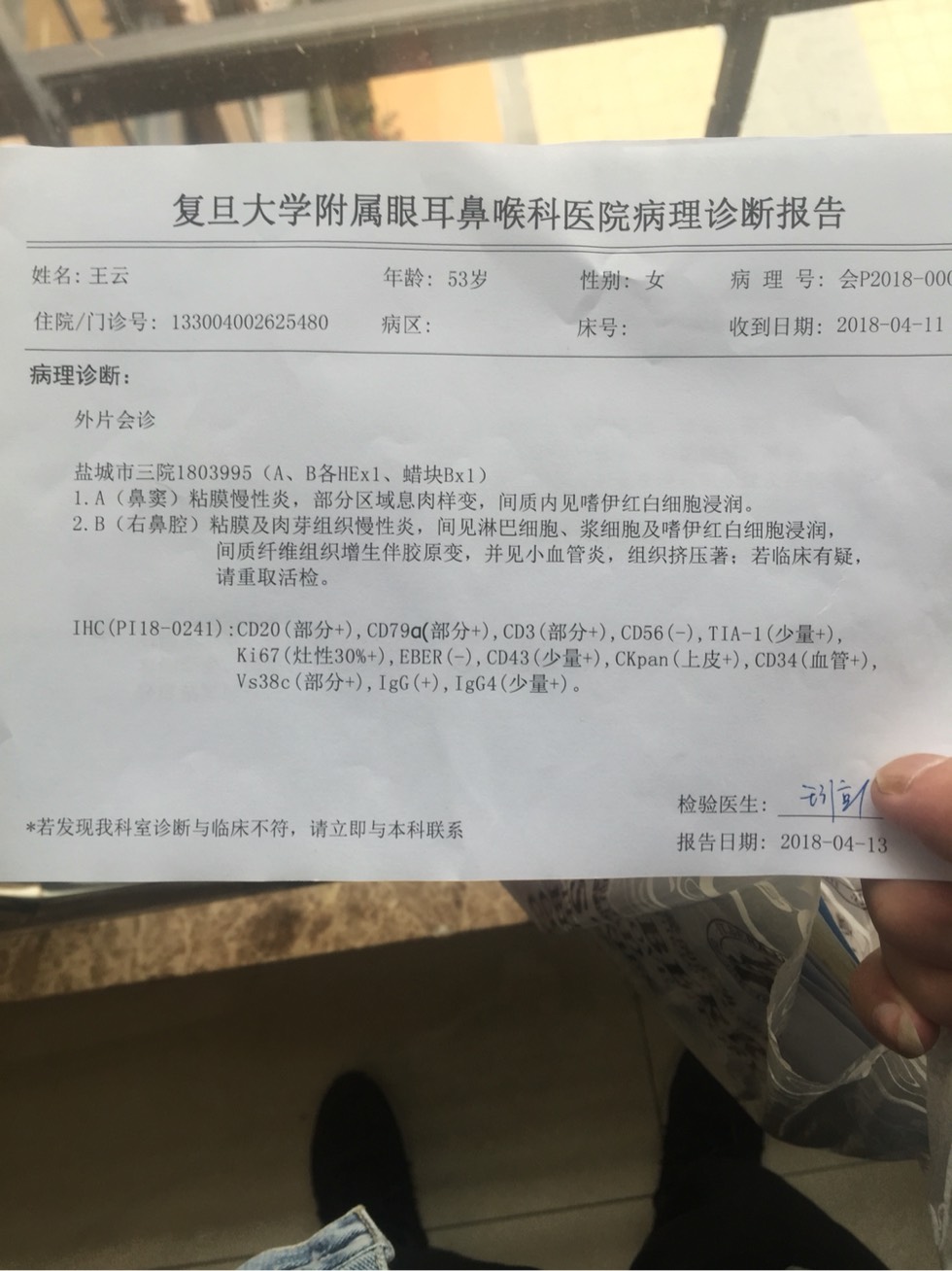 180701tn77r7s4z44zrkwz.jpg