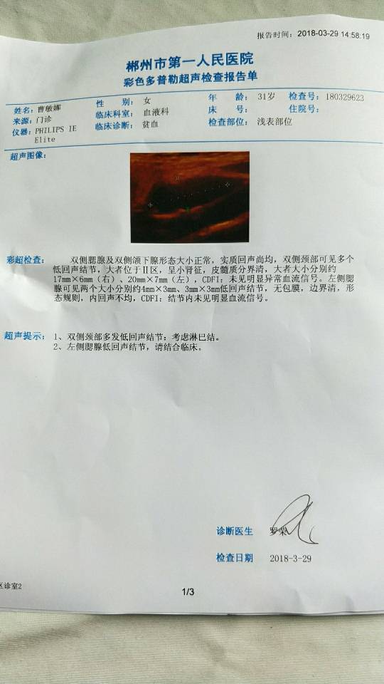 214125xbz3qkc35171xllb.png