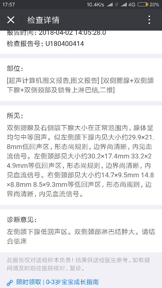 160502cbb1wnmwzm1s4xpo.png