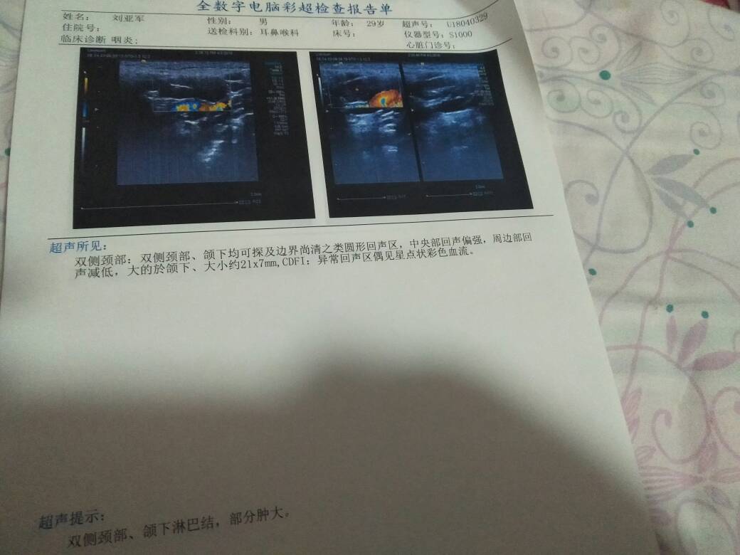 222224qh3p63kjkfozvshd.jpg