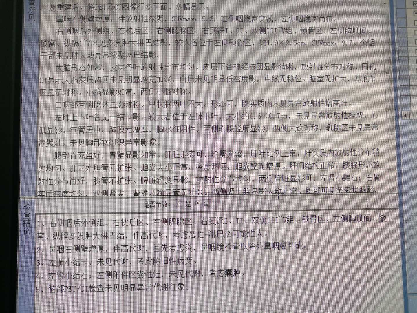 091538hqqzrcqd11lnrqon.jpg