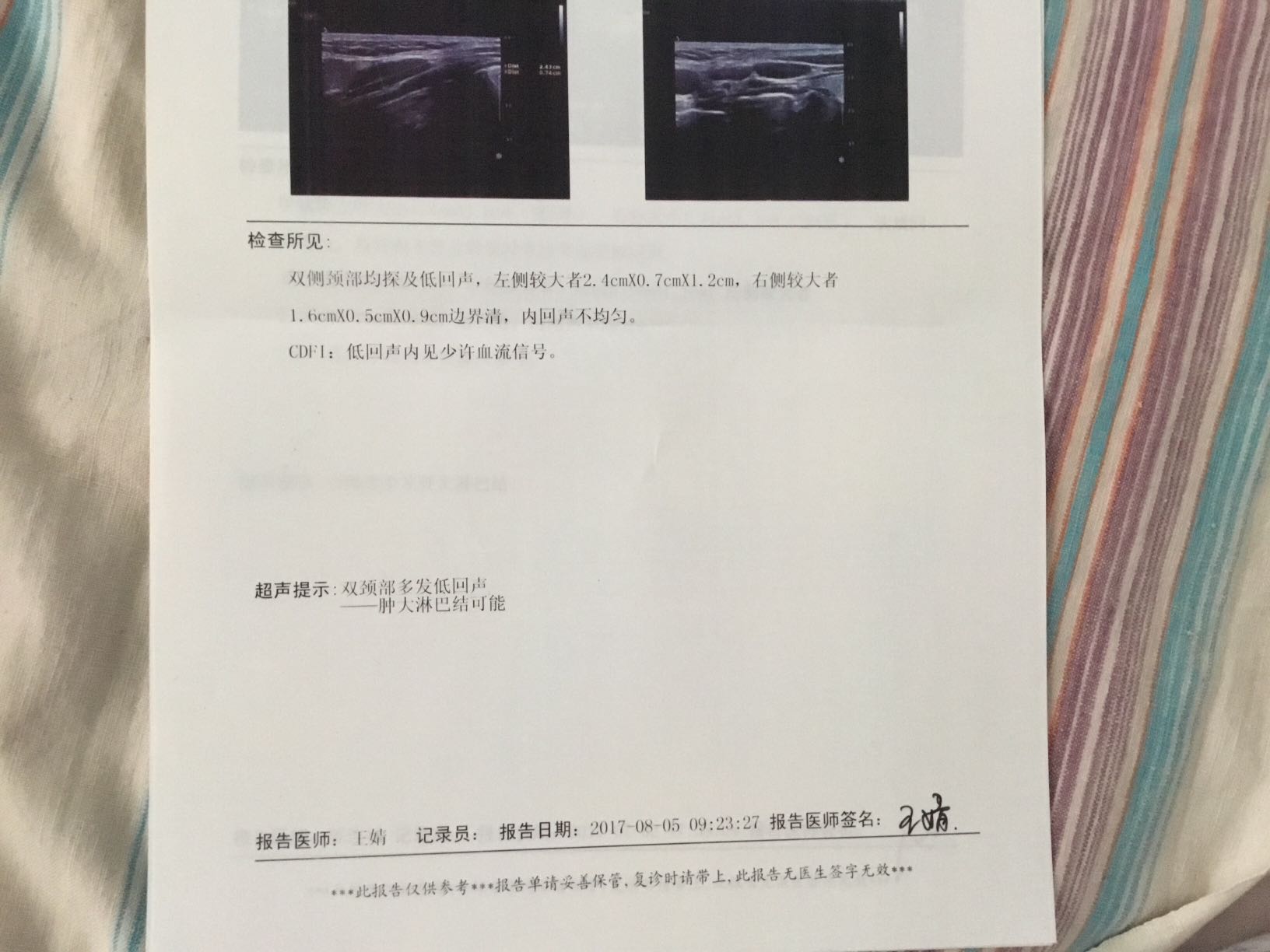 152650xi33etplcnjijecj.jpeg