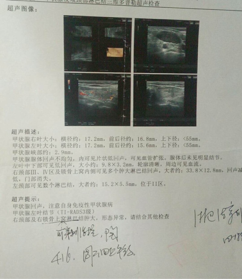195552pxgamase4g9maa41.jpg