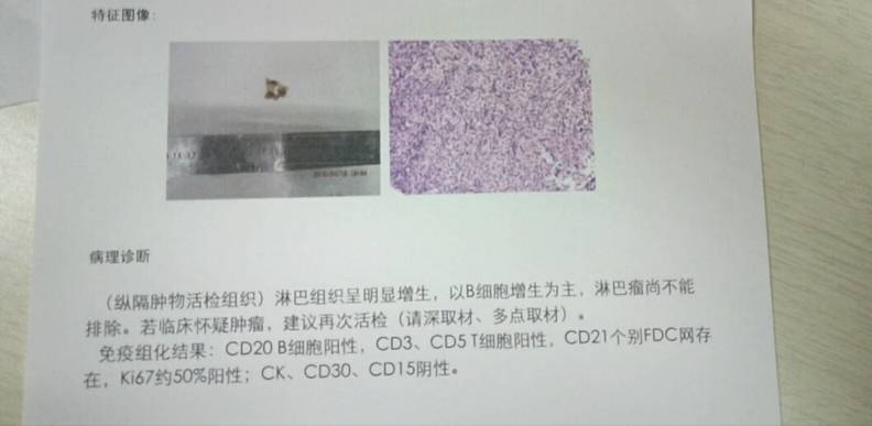 160031cs5rkqfz58ib5mg5.jpg