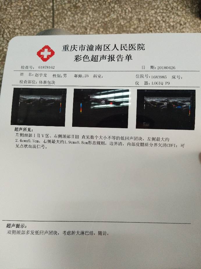 030819e5ccs41hd4e7oq74.jpg