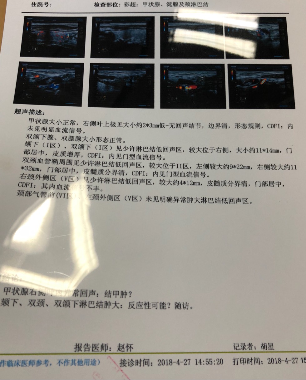 065603u50wj7qsvqdzx78d.jpg