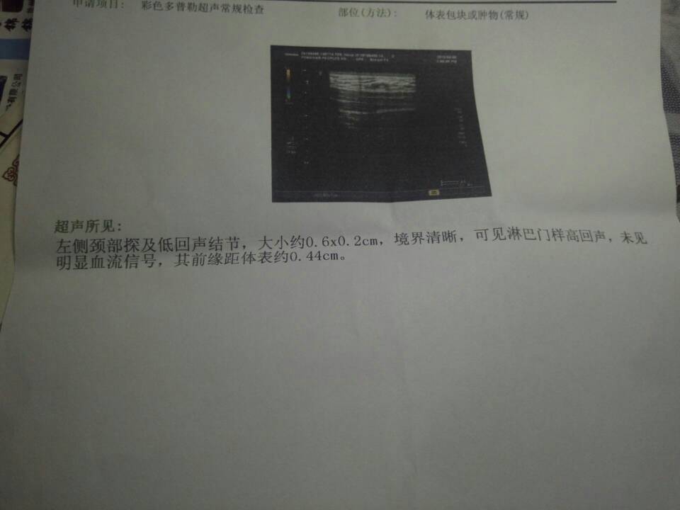 225819d1261b7dbq2cd221.jpg