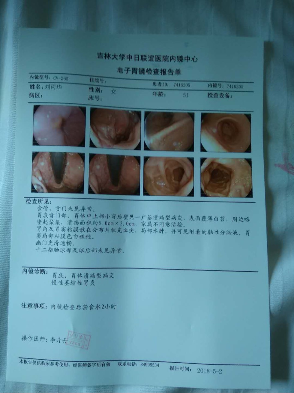 212457tbdnppxbznubsppi.jpg