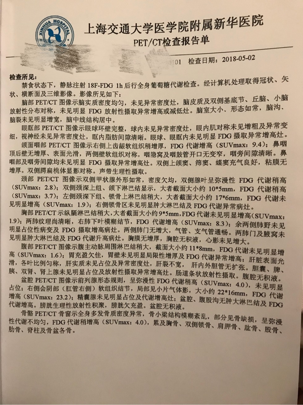 195225u7eonqn7fp78poc8.jpg