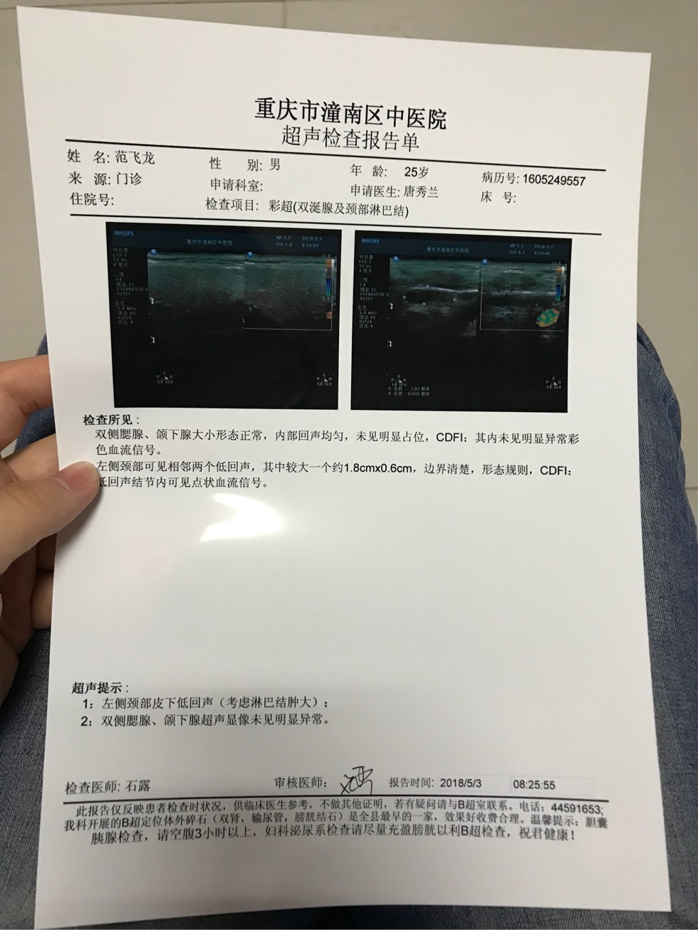 091616ym8uce8x7cm74u77.jpg