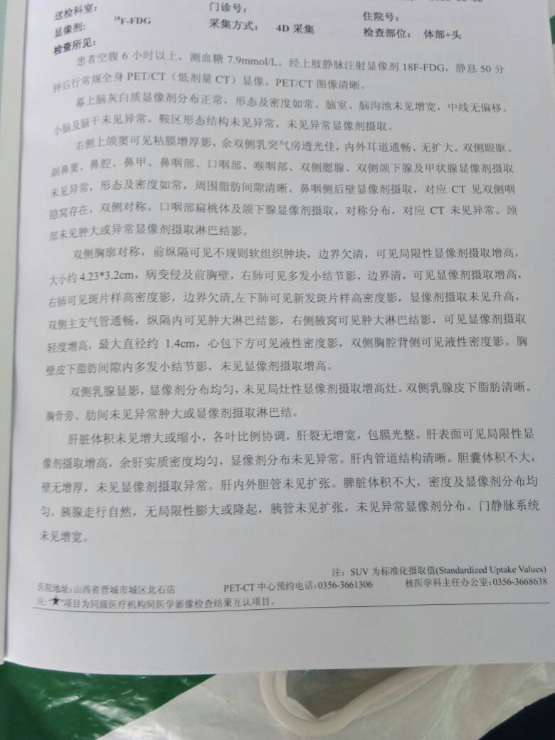 162623d7qq11m42zmbfigl.jpg