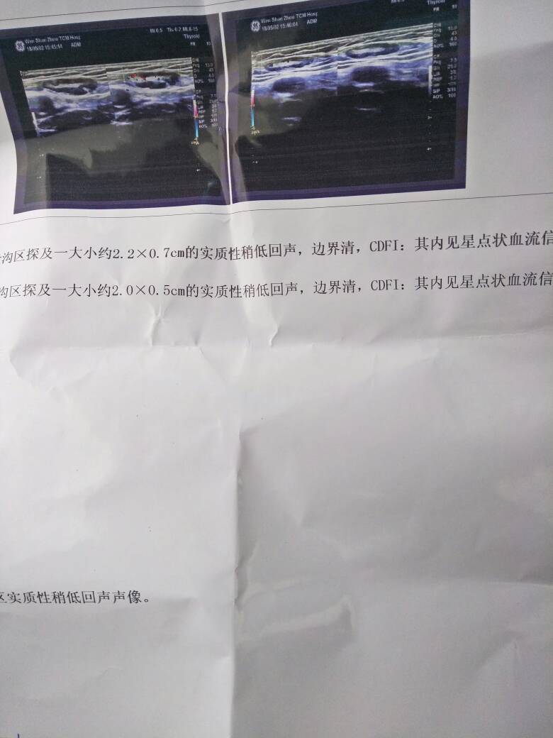 154702etpvt3vkkvmfviu6.jpg