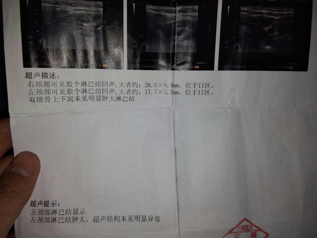 172143xnwhavo4wn2ntao2.jpg