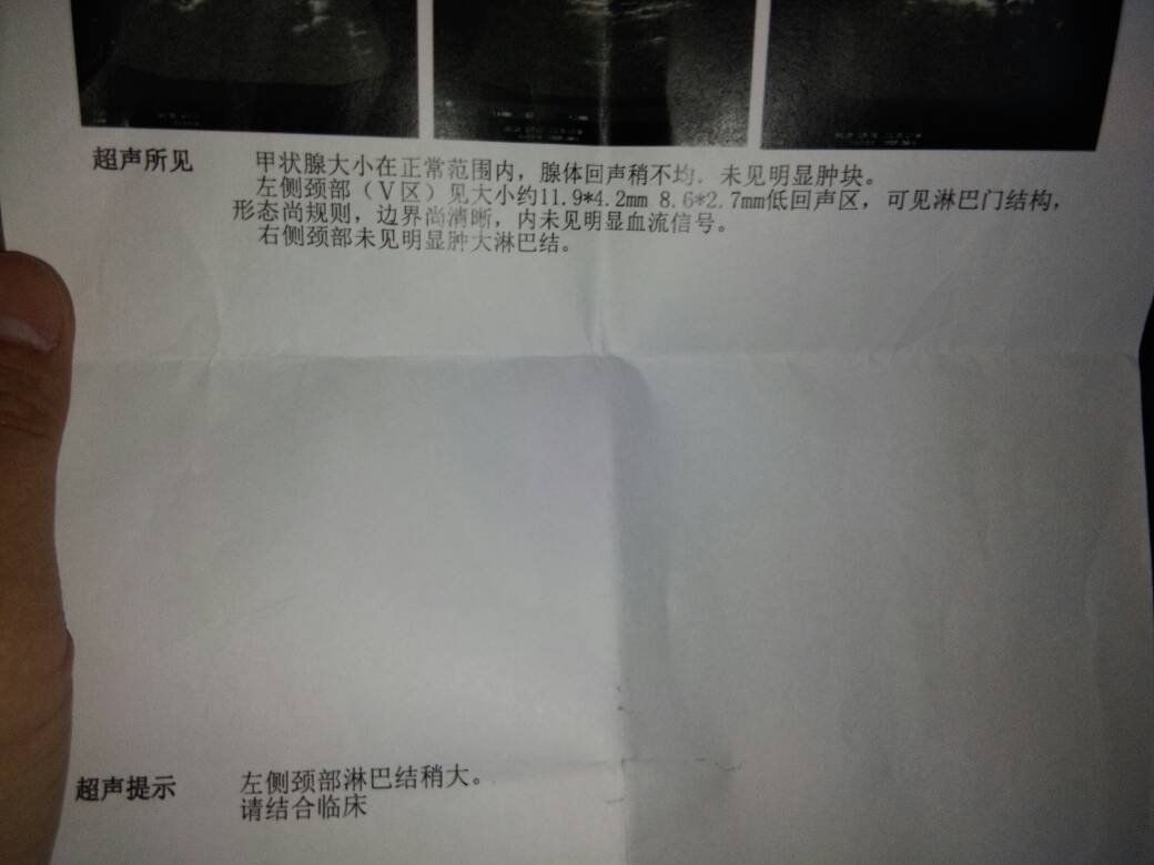 172144ta1tczs225s4ct1r.jpg